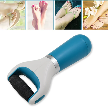 Electric Foot Callus Remover – Waterproof Electronic Dry Foot File with Regular Coarse Roller for Hard and Dead Skin